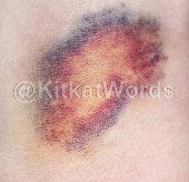 Bruise Image