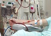 Dialysis Image