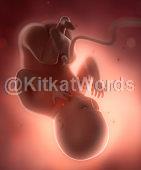 Foetus Image