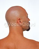 alopecia Image