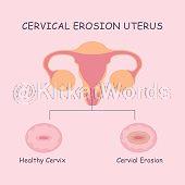 cervix Image