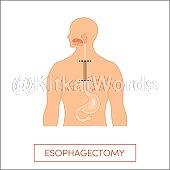 esophagus Image