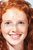 freckle Image
