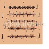 suture Image